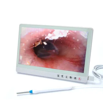 3,9 мм HD Очиститель для ушей с 10 дюймовым экраном, эндоскоп для удаления ушной серы, ложка для носа, горла, камера для осмотра полости рта
